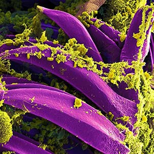 African Swine Fever (ASF)