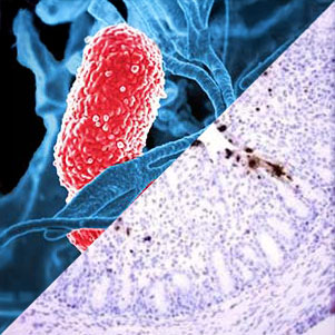 Porcine Epidemic Diarrhea virus (PEDv) & Porcine DeltaCoronavirus (PDCoV)